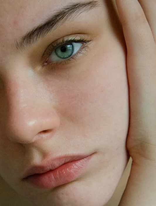 A close look at a woman’s skin after using sun-damaged skin solutions.
